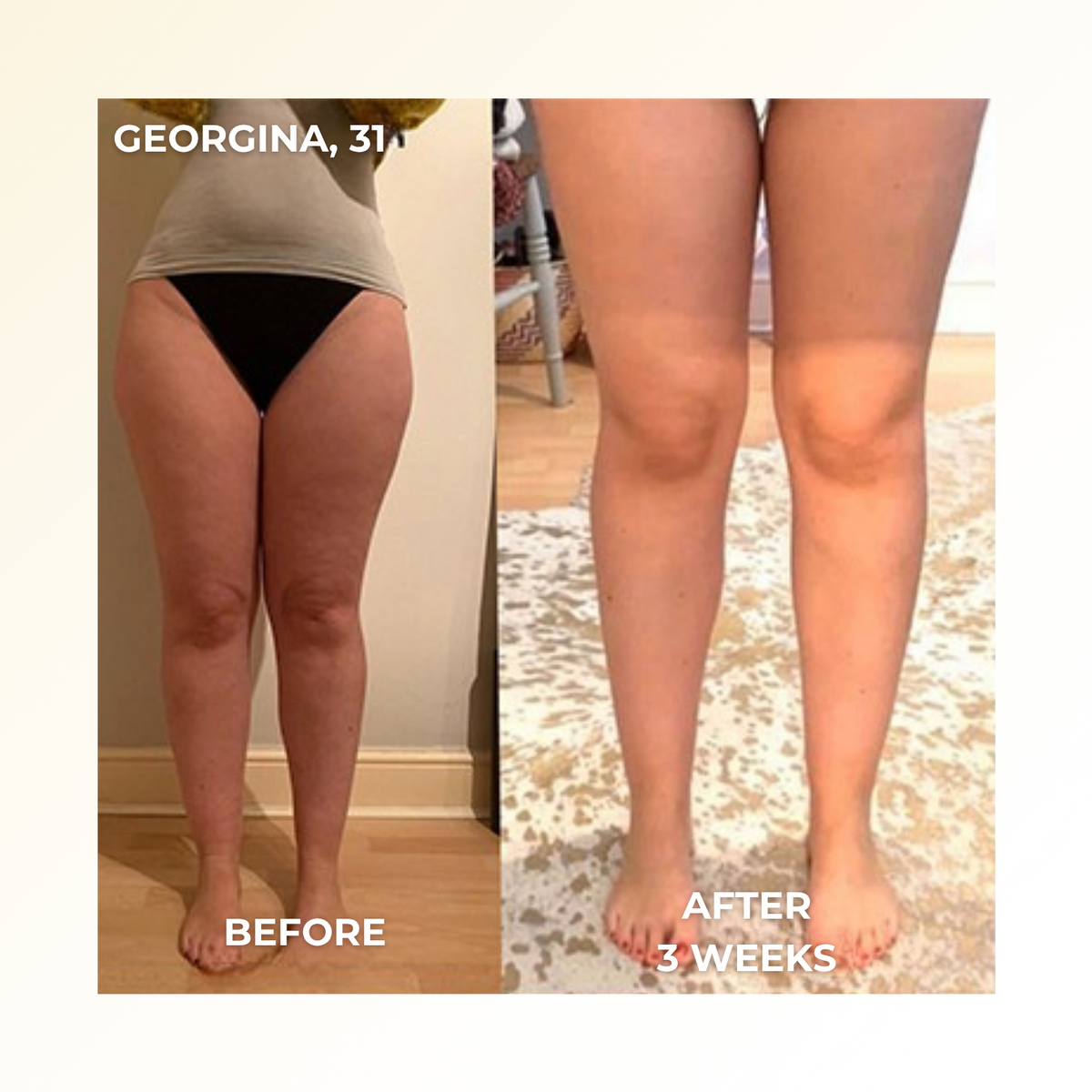 Veluvia - 4-in-1 Fascia Sculpting Blade