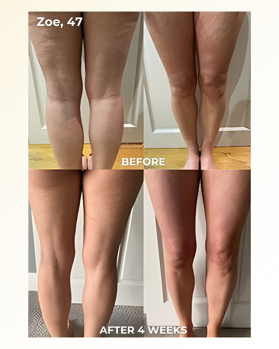 Veluvia - 4-in-1 Fascia Sculpting Blade