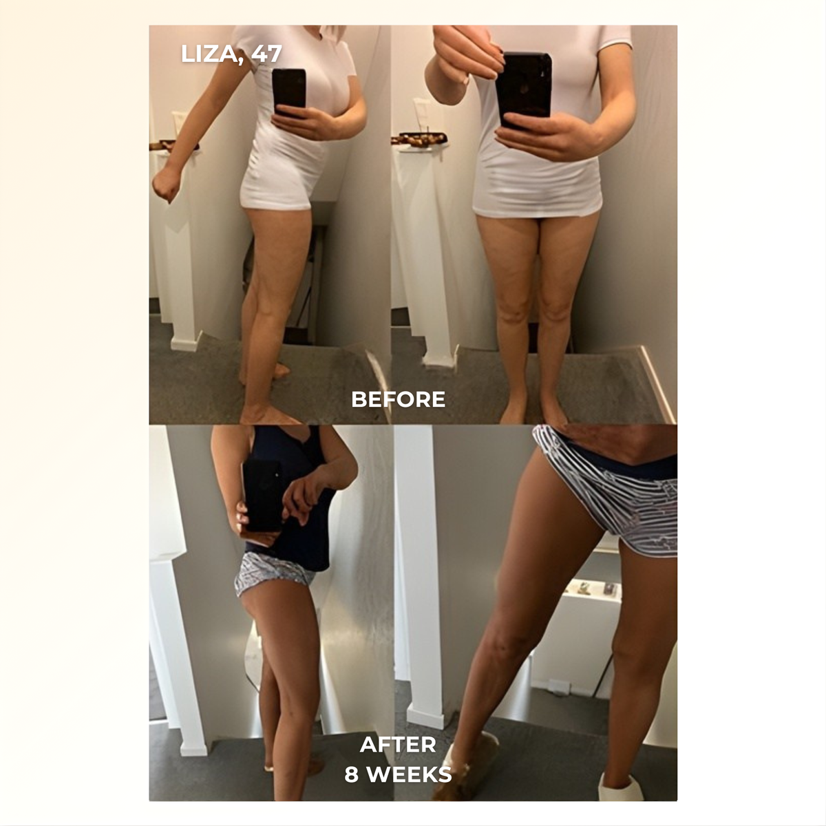 Veluvia - 4-in-1 Fascia Sculpting Blade