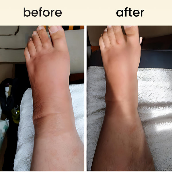 FreeFlow - lymphatic drainage roller